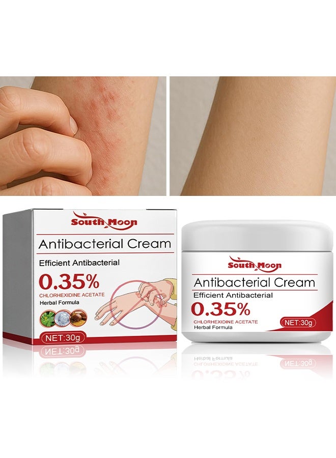 SOUTH MOON Antibacterial Cream, Psoriasis Cream, Natural Chinese Herbal Eczema Psoriasis Creams Dermatitis And Eczema Pruritus Psoriasis Ointment, Psoriasis Creams, Psoriasis Treatment, Antibacterial Cream, For Body Itching 30G - Image 1